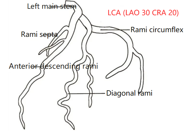 Hemadostenosis